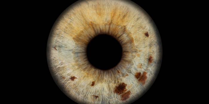 Akių fotografija Klaipėdoje - Viešbučiai Klaipėdoje